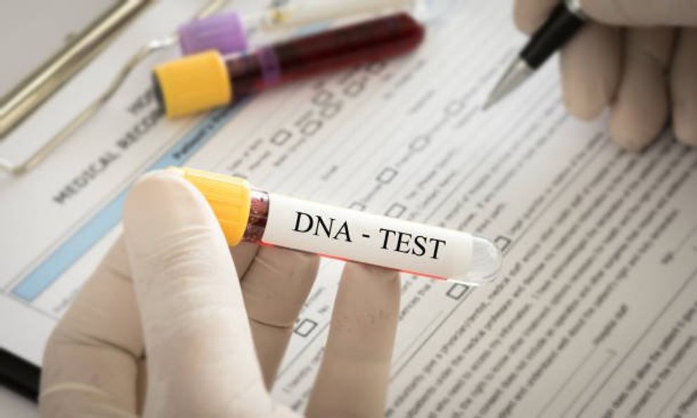 Un test  ADN. | Source: Pexels